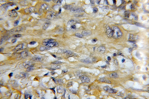 [11454-1-AP-150UL] MZB1 Polyclonal antibody