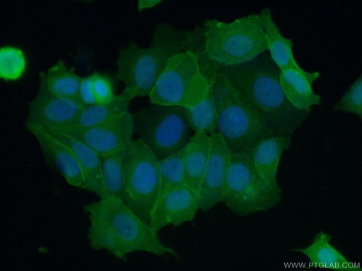[11456-1-AP-20UL] S100A16 Polyclonal antibody