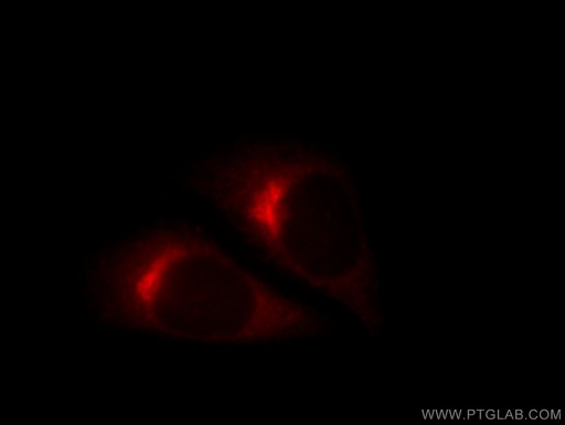 [11457-1-AP-20UL] COPE Polyclonal antibody