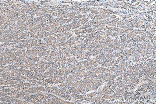 [11458-1-AP-20UL] PRUNE2 Polyclonal antibody