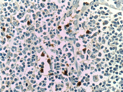 [11461-1-AP-150UL] LILRA2 Polyclonal antibody