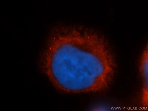[11463-1-AP-150UL] COX4I2 Polyclonal antibody