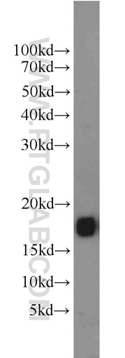 [11465-1-AP-20UL] FXYD7 Polyclonal antibody