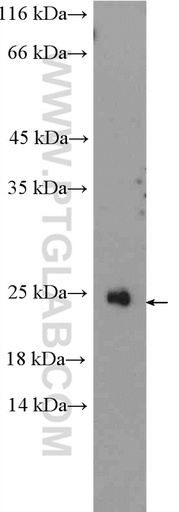 [11466-1-AP-20UL] RAX2 Polyclonal antibody