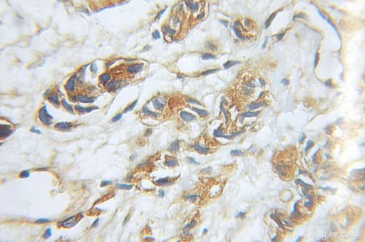 [11469-1-AP-150UL] PSMD5 Polyclonal antibody