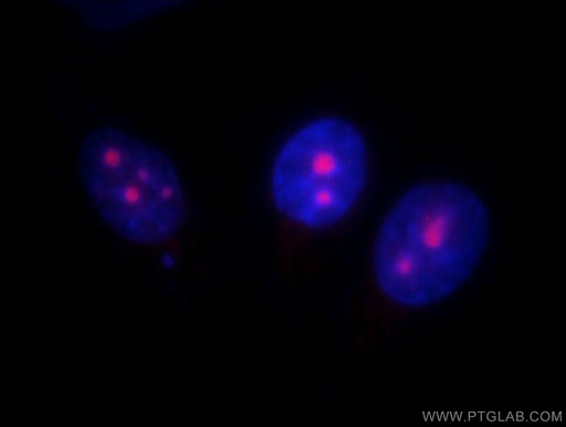 [11474-1-AP-20UL] UTP14A Polyclonal antibody