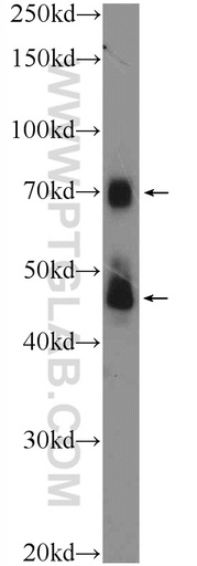 [11476-1-AP-20UL] TRIM5 Polyclonal antibody