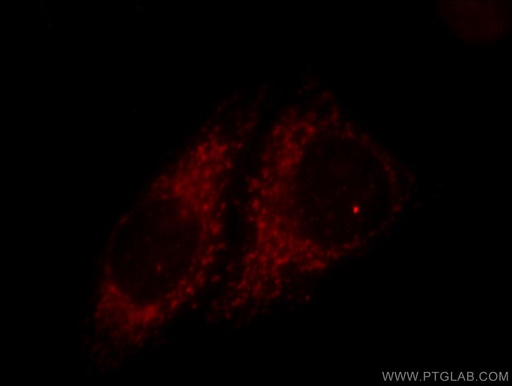 [11479-1-AP-20UL] TIMM9 Polyclonal antibody