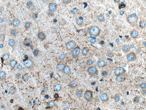 [11484-1-AP-20UL] SCN1B Polyclonal antibody