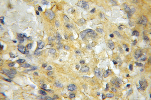 [11485-2-AP-20UL] SCRN2 Polyclonal antibody
