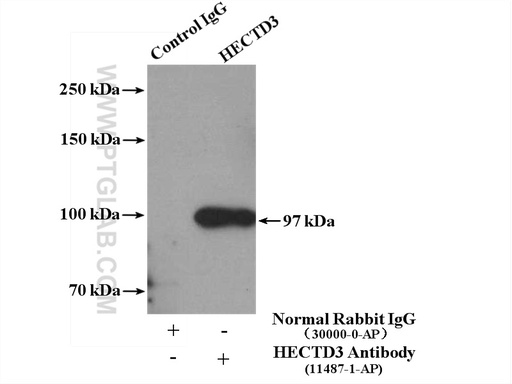 [11487-1-AP-150UL] HECTD3 Polyclonal antibody