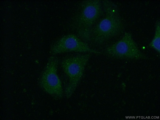 [11490-2-AP-20UL] CAPS1 Polyclonal antibody