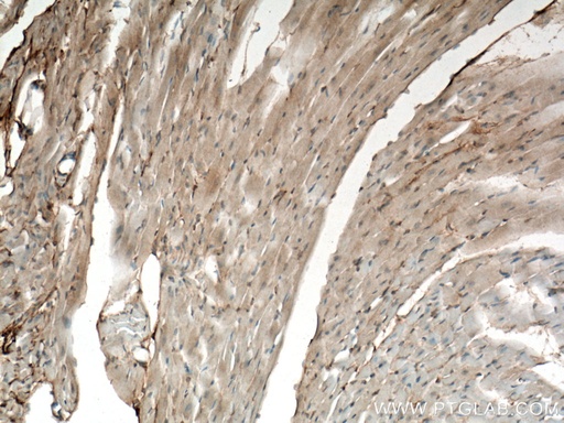 [11497-1-AP-20UL] Apelin Polyclonal antibody