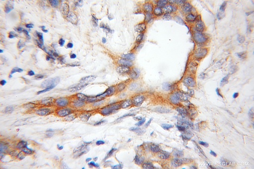 [11498-1-AP-150UL] COX11 Polyclonal antibody