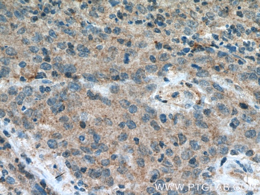 [11499-1-AP-20UL] FBXW2 Polyclonal antibody