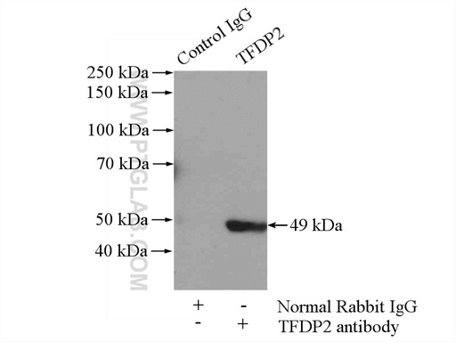 [11500-1-AP-150UL] TFDP2 Polyclonal antibody