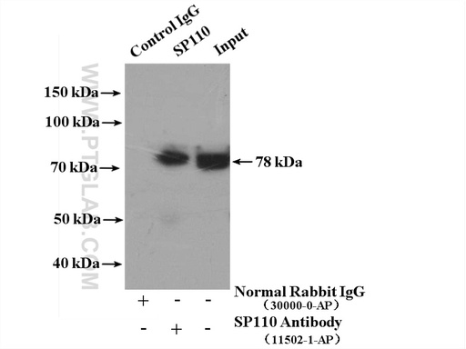 [11502-1-AP-150UL] SP110 Polyclonal antibody