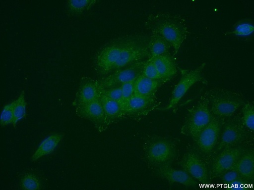 [11503-1-AP-150UL] FRS2 Polyclonal antibody