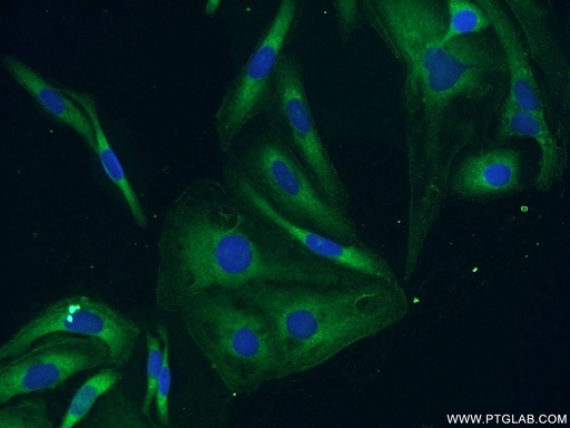 [11504-2-AP-150UL] BubR1 Polyclonal antibody