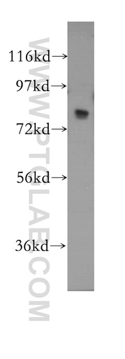 [11505-1-AP-150UL] MED17 Polyclonal antibody
