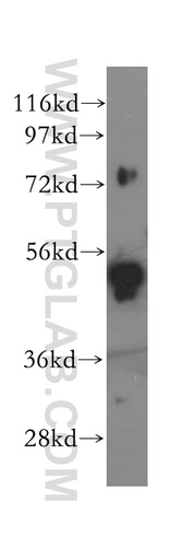 [11506-1-AP-20UL] SNX4 Polyclonal antibody