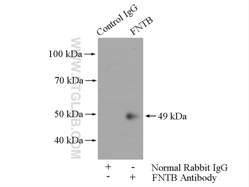 [11507-1-AP-150UL] FNTB Polyclonal antibody
