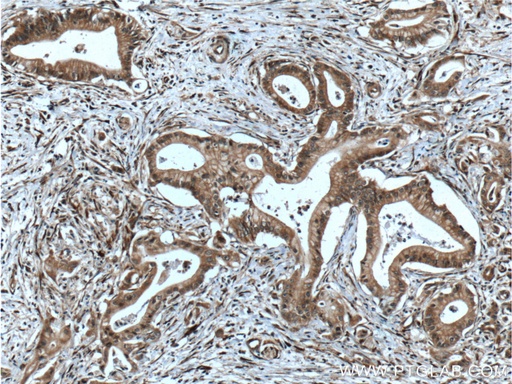 [11508-1-AP-20UL] PTP4A1/PRL1 Polyclonal antibody