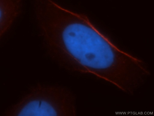 [11509-1-AP-20UL] CNN3 Polyclonal antibody