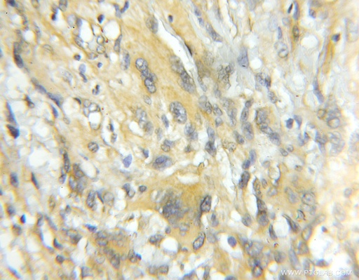 [11511-1-AP-150UL] TRIM44 Polyclonal antibody