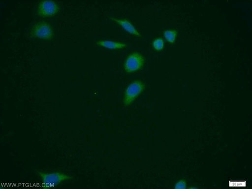 [11512-1-AP-20UL] PUS1 Polyclonal antibody