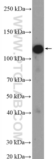 [11513-1-AP-20UL] PHF15 Polyclonal antibody