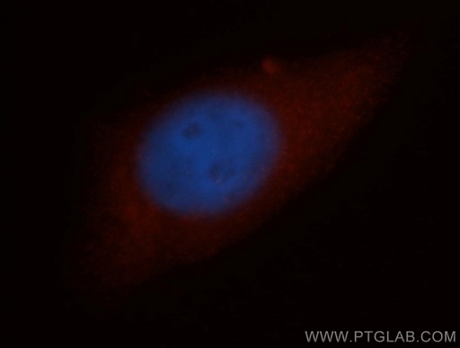 [11515-1-AP-20UL] NCAPH Polyclonal antibody