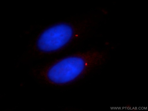[11517-1-AP-150UL] CENPJ Polyclonal antibody