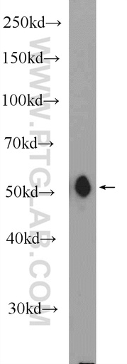 [11518-1-AP-20UL] MFSD10 Polyclonal antibody