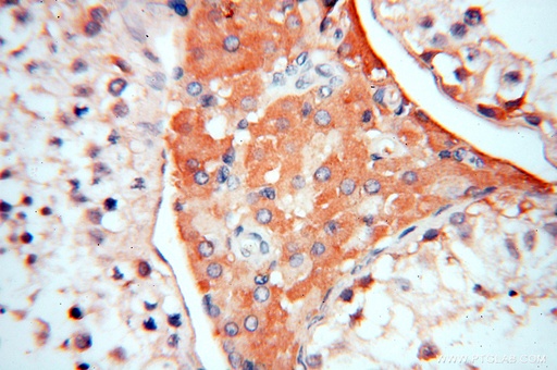 [11519-1-AP-20UL] Symplekin Polyclonal antibody