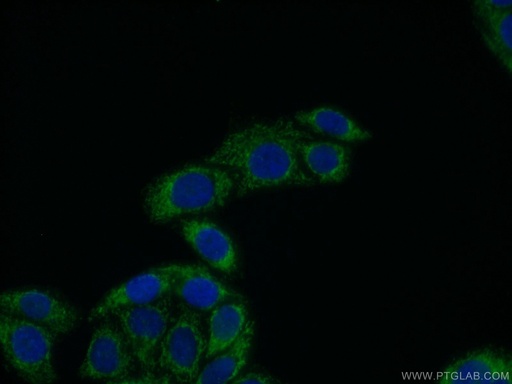[11521-1-AP-150UL] ECM1 Polyclonal antibody