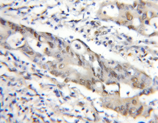 [11526-1-AP-20UL] MEPCE Polyclonal antibody