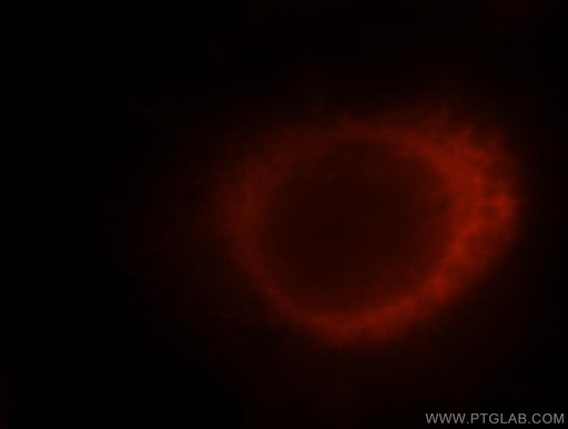 [11528-1-AP-20UL] SRP14 Polyclonal antibody