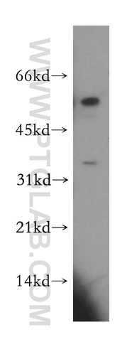 [11530-1-AP-150UL] CCDC28B Polyclonal antibody