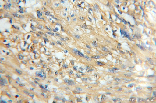 [11533-1-AP-150UL] CaMKII Beta Polyclonal antibody