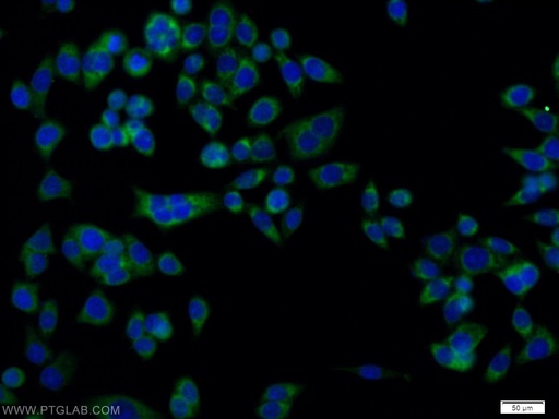 [11535-1-AP-20UL] DCI Polyclonal antibody