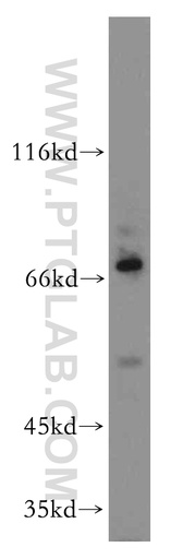 [11540-1-AP-20UL] PLAGL2 Polyclonal antibody