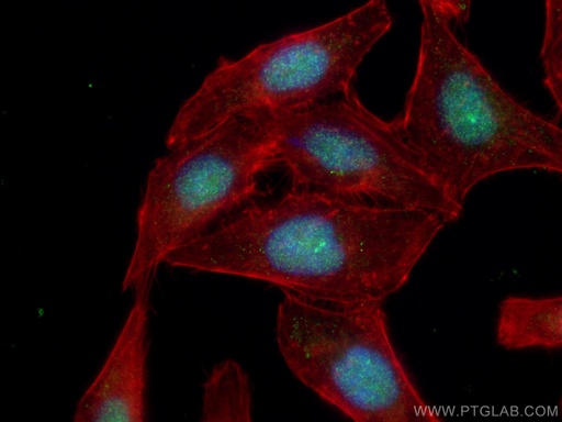 [11542-1-AP-20UL] ORC5L Polyclonal antibody