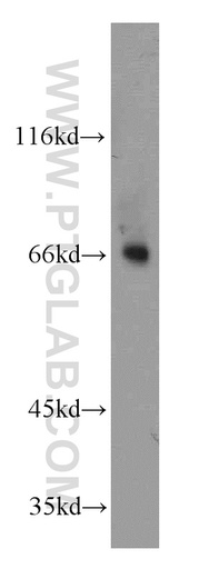 [11545-1-AP-150UL] MOXD1 Polyclonal antibody