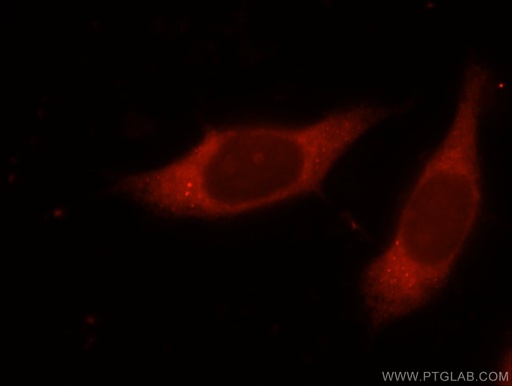 [11546-1-AP-20UL] NMT1 Polyclonal antibody