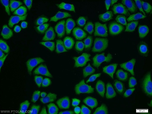 [11549-1-AP-20UL] CAMKK2 Polyclonal antibody