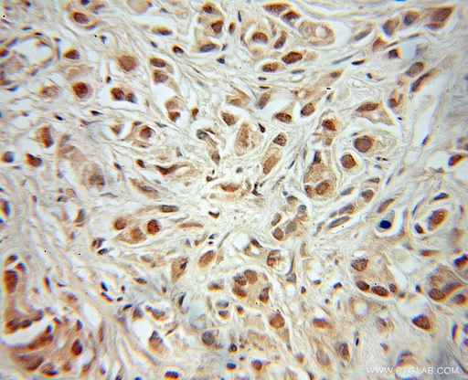 [11550-1-AP-20UL] MEIS2 Polyclonal antibody