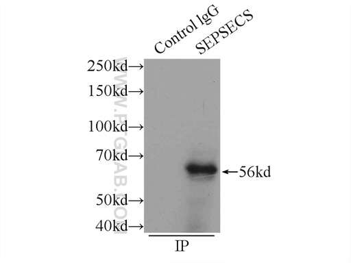[11551-1-AP-20UL] SLA/LP Polyclonal antibody