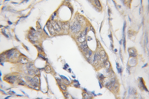[11553-1-AP-150UL] CHRNB1 Polyclonal antibody