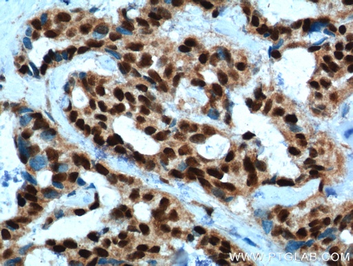 [11555-1-AP-150UL] PYGO2 Polyclonal antibody